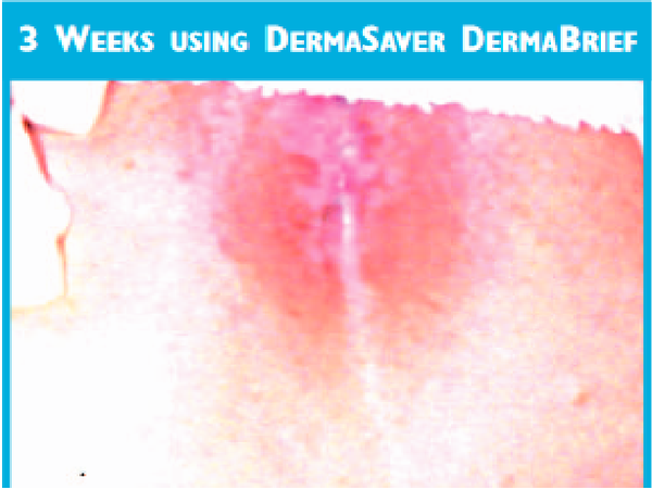 DermaBrief™ Pull Up - DB1300