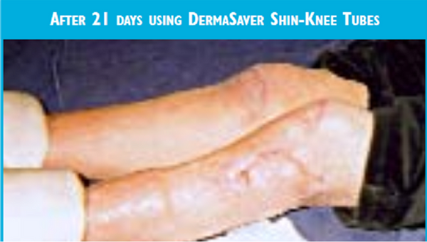 Shin~Knee Tube - SKT1350