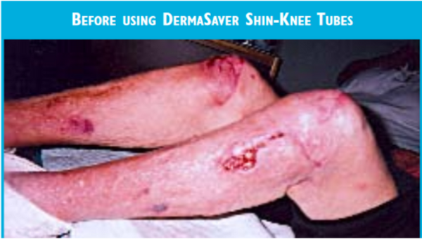 Shin~Knee Tube - SKT1350
